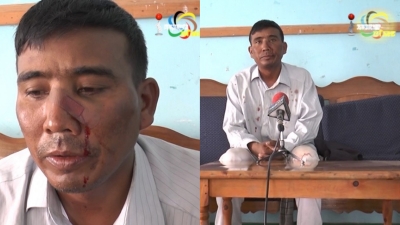 Rickshaw puller accuses police sub-inspector of assaulting him over fare at Keishampat Thiyam Leikai